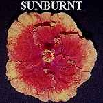 Sunburnt.jpg